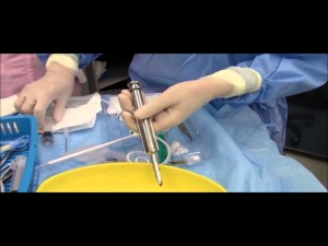 Insertion of Tenckhoff's catheter